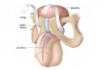 Male Slings for Post Prostatectomy Incontinence